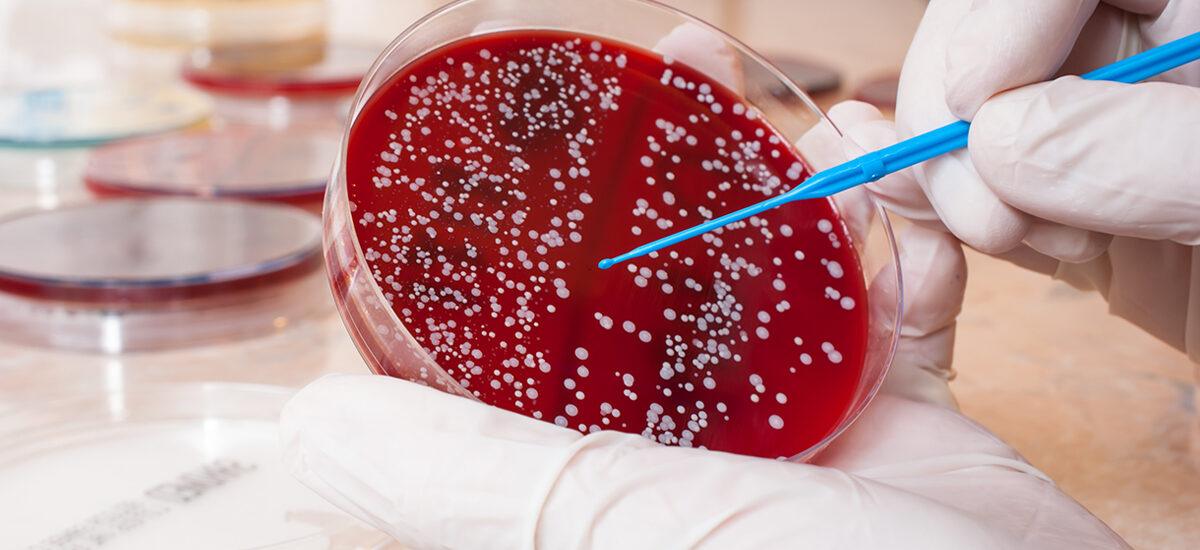 Global Staphylococcus Aureus Testing Industry