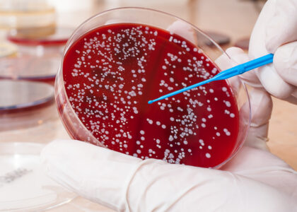 Global Staphylococcus Aureus Testing Industry