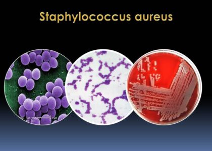 Global Staphylococcus Aureus Testing Industry