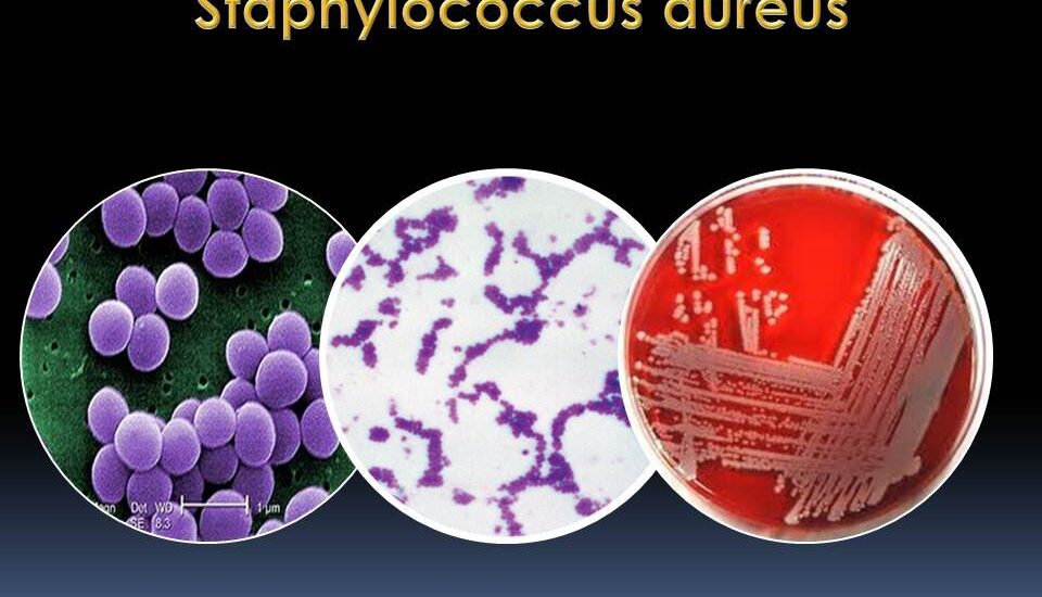 Global Staphylococcus Aureus Testing Industry