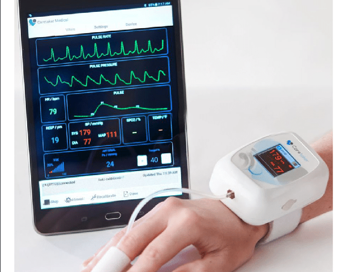 Global Wearable Blood Pressure Monitor Industry