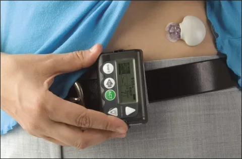 Glucose Monitoring Devices Market