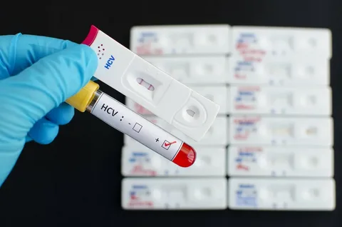 HIV Test Kits Market