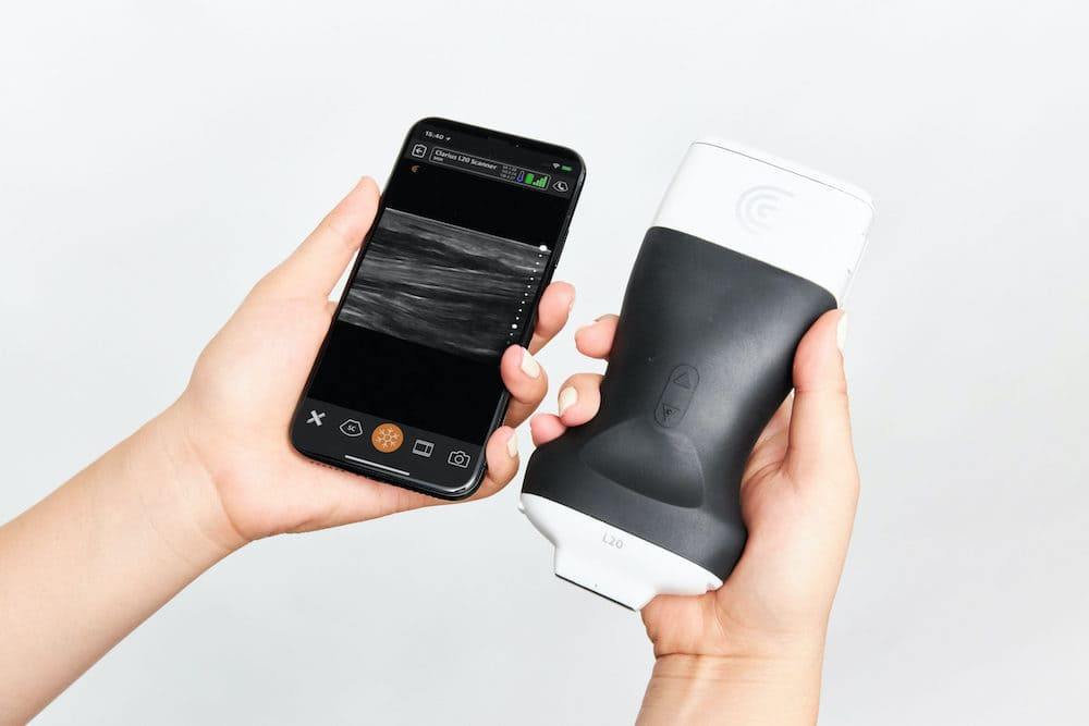 Handheld Ultrasound Scanners Market