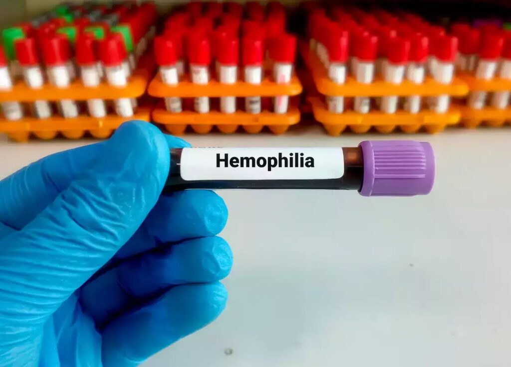 Hemophilia Treatment Industry