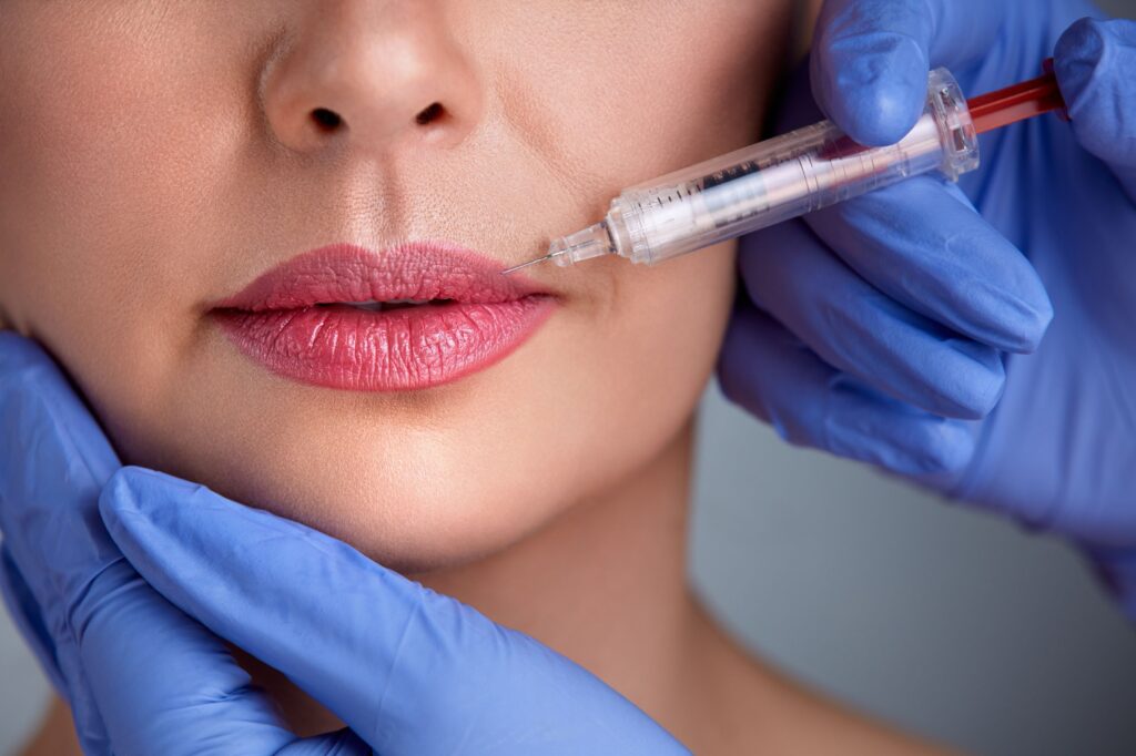 Lip Fillers Industry