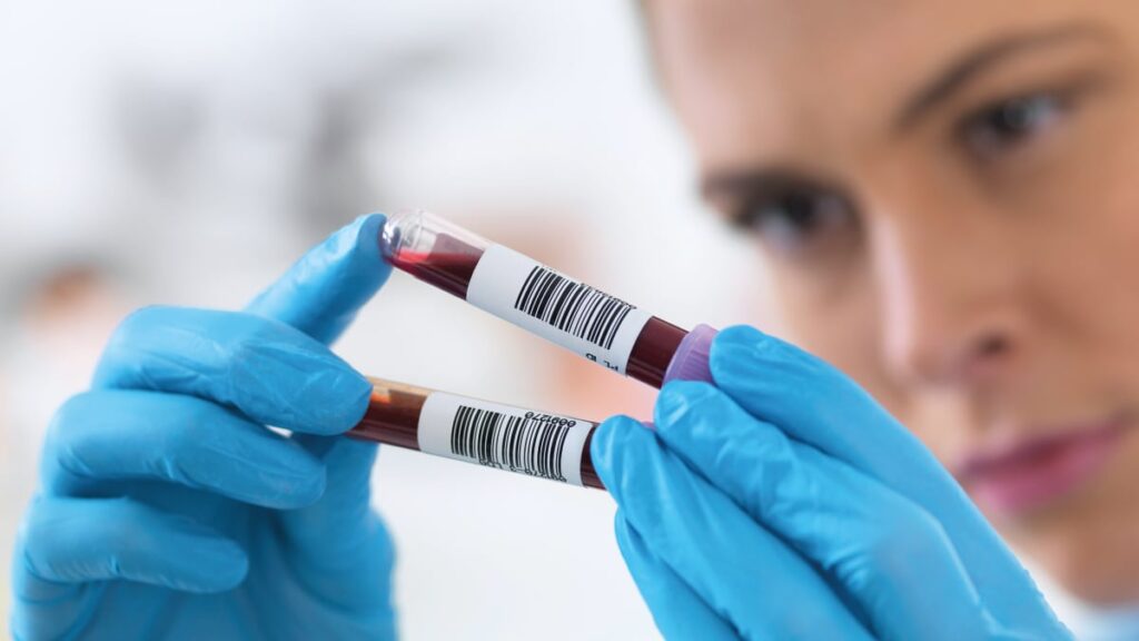 Liquid Biopsy Market