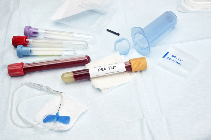 Prostate-Specific Antigen Testing Industry