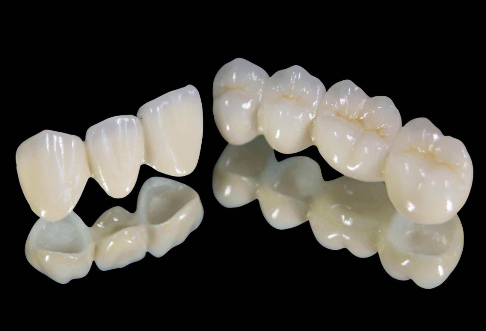 Zirconia Based Dental Ceramics Market