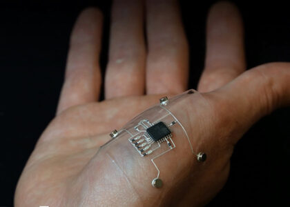 Stretchable Electronics Market