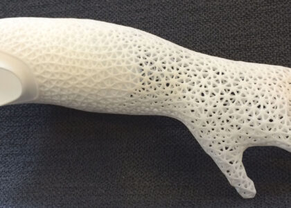 Global 3D Printed Prosthetics Industry