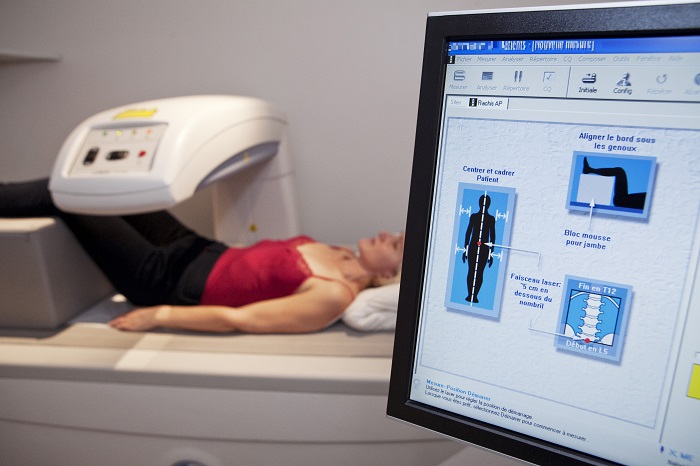 Bone Densitometer Market