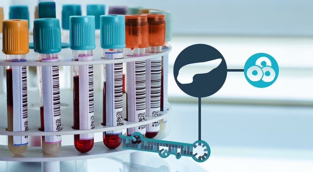 Global Cardiac Biomarker Diagnostic Test Kits Industry