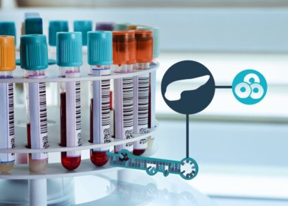 Global Cardiac Biomarker Diagnostic Test Kits Industry