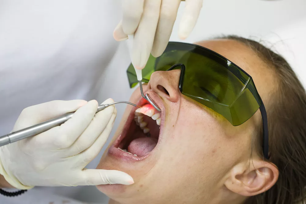 Dental Lasers Market