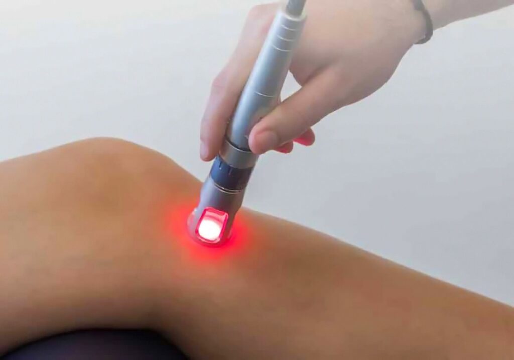 Endovenous Laser Therapy Industry