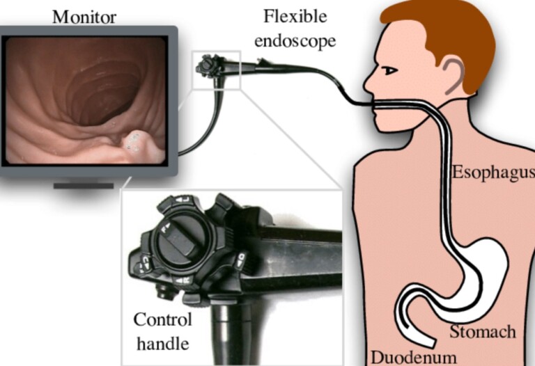 Flexible Endoscopes Market