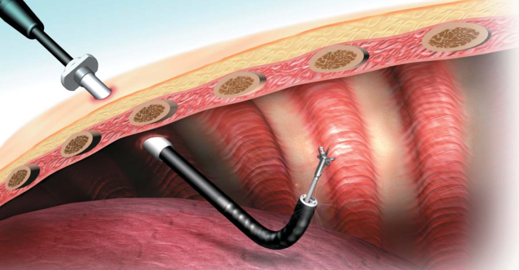 Gamma Probe Devices Market