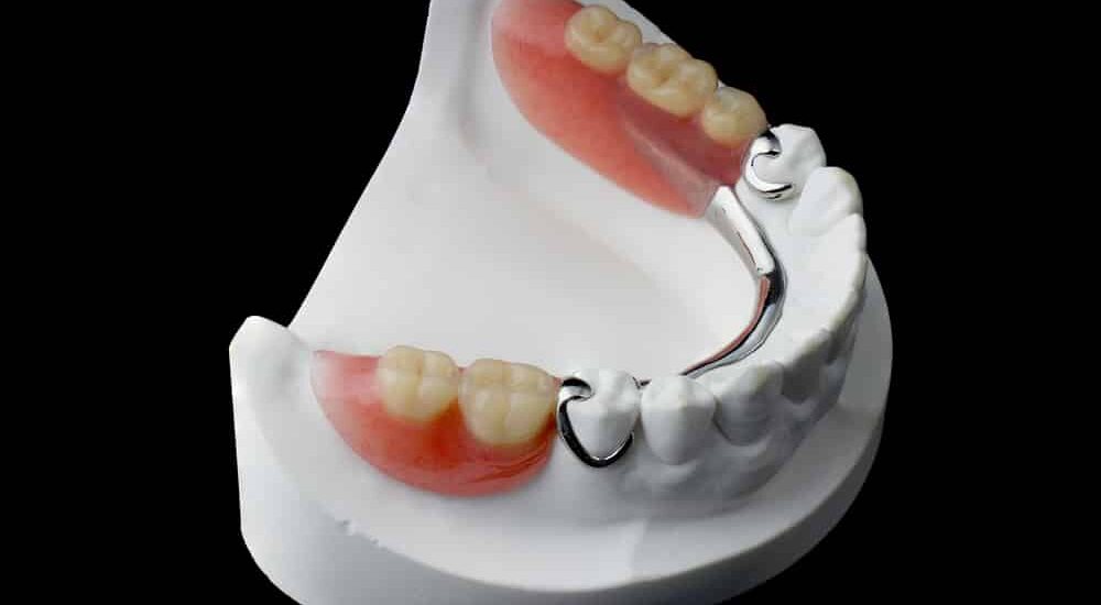 Global Acrylic Teeth Industry