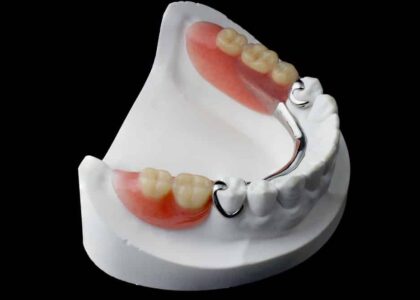 Global Acrylic Teeth Industry