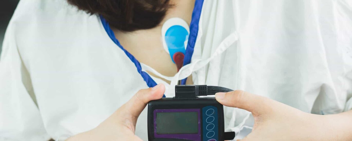 Global Cardiac Ambulatory Monitoring Industry