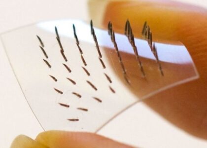 Global Dissolving Microneedle Industry