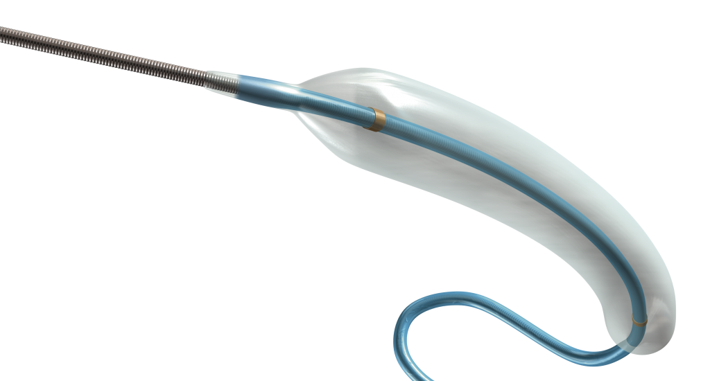 Global Dual Balloon Angioplasty Catheter Industry