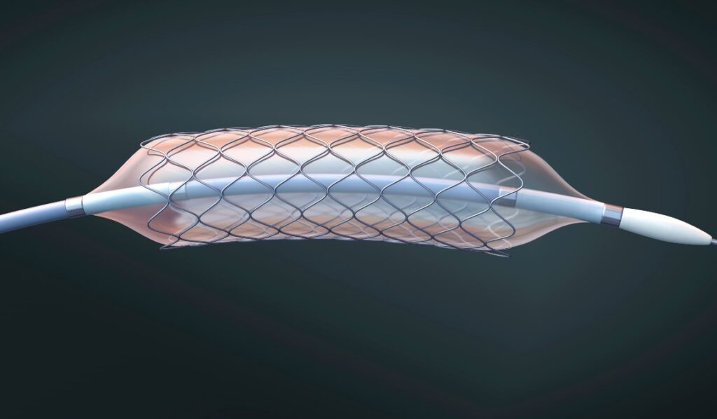 Global Stent Graft Balloon Catheter Industry