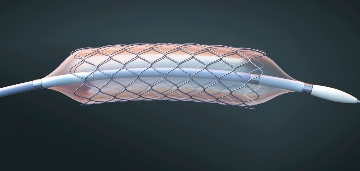 Global Stent Graft Balloon Catheter Industry