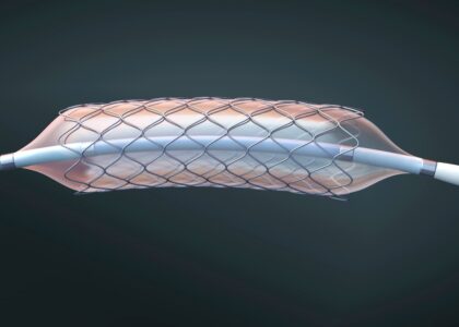 Global Stent Graft Balloon Catheter Industry