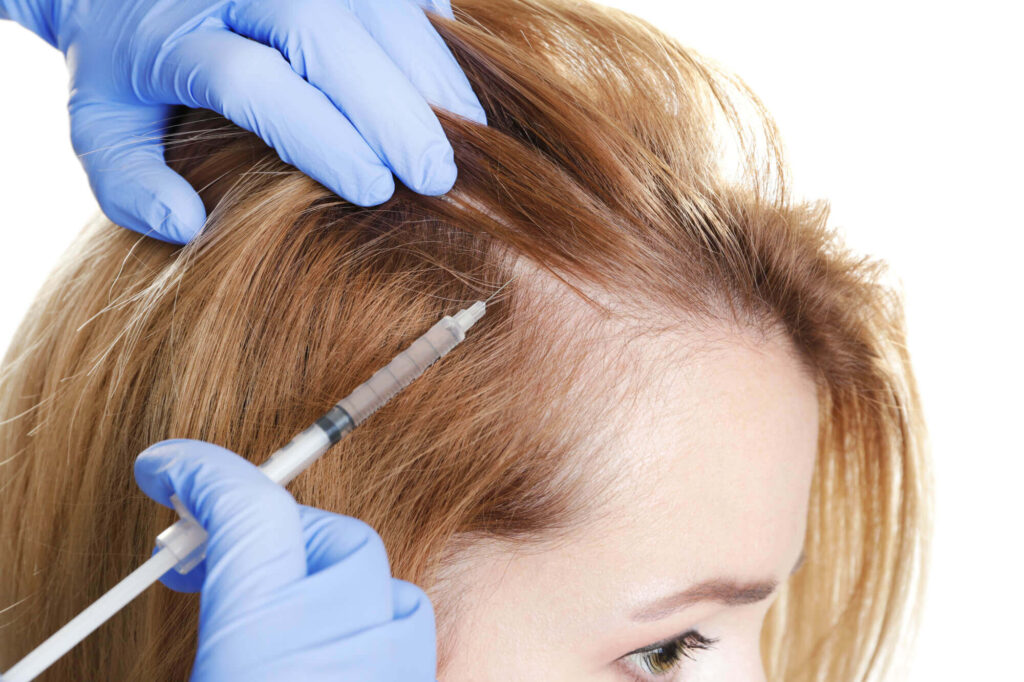 Global Hair Restoration Market