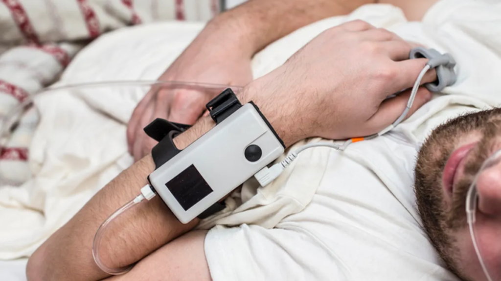 Home Sleep Screening Devices Market