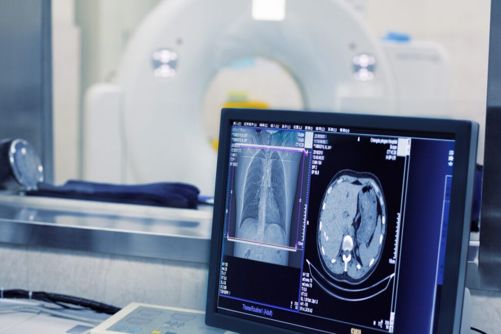 Intracardiac Imaging Market