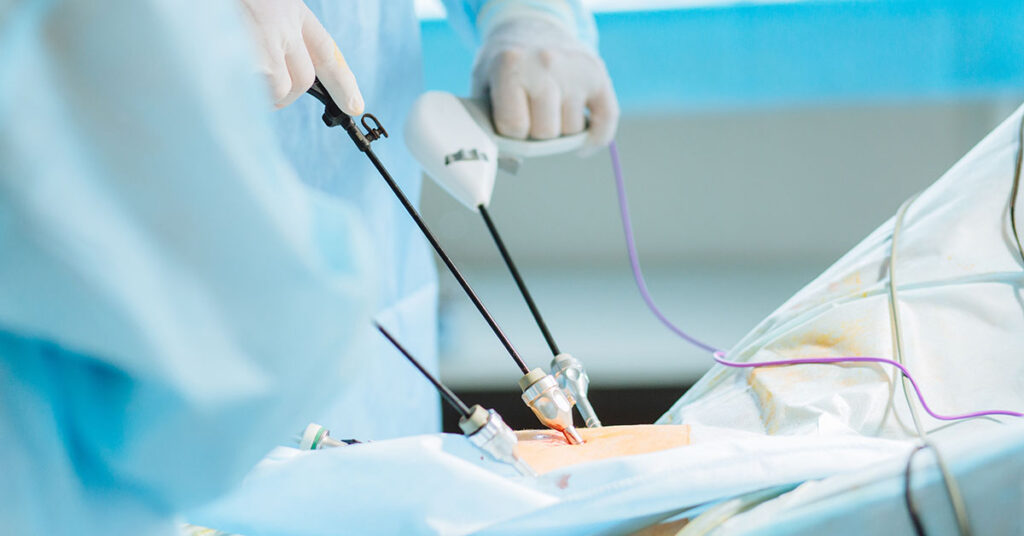 Laparoscopic Gynaecological Procedures Market