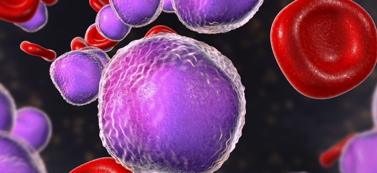 Global Large Granular Lymphocytic Leukemia (LGLL) Therapeutics Industry