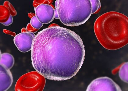 Global Large Granular Lymphocytic Leukemia (LGLL) Therapeutics Industry