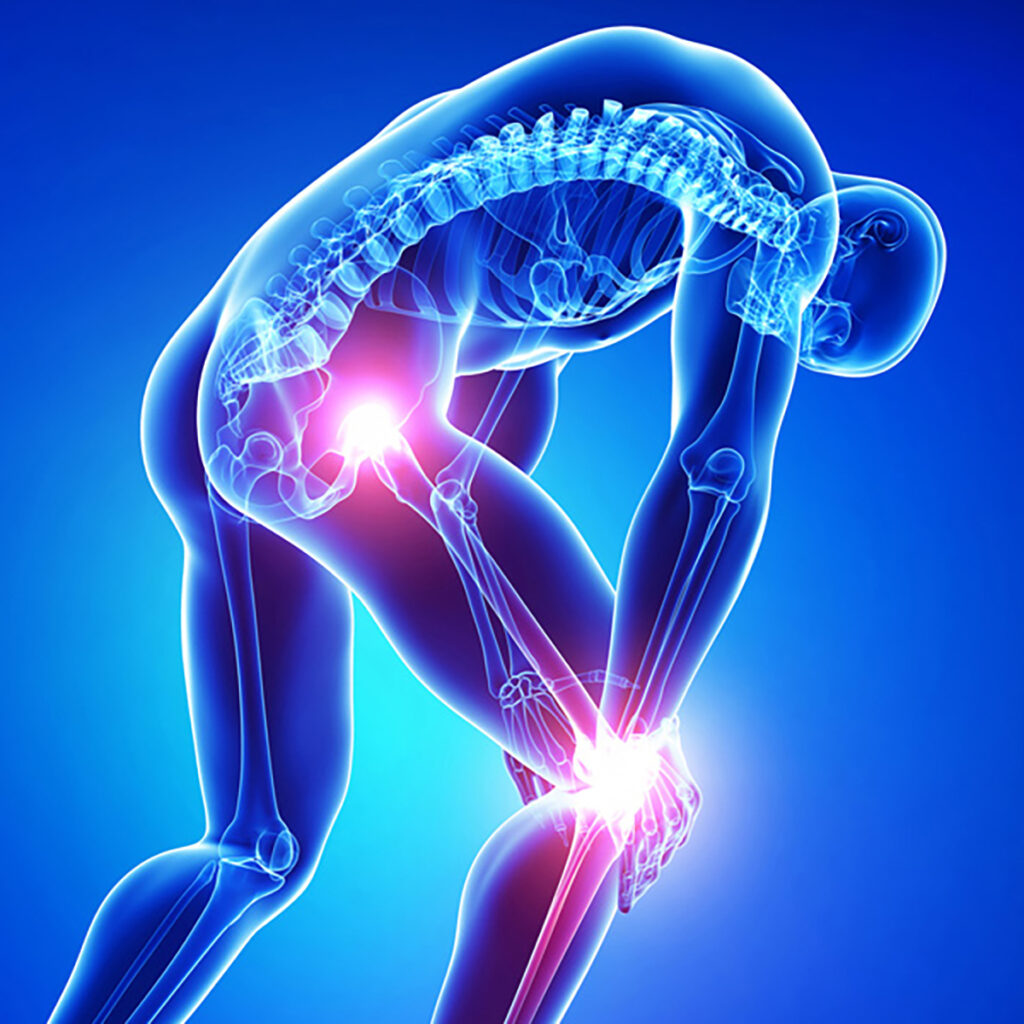 Global Orthopedic Oncology Market