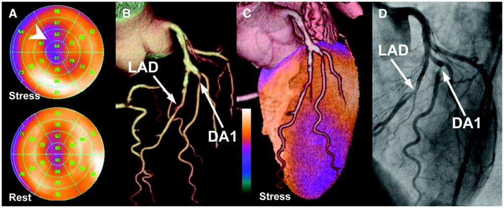 Perfusion Imaging Market