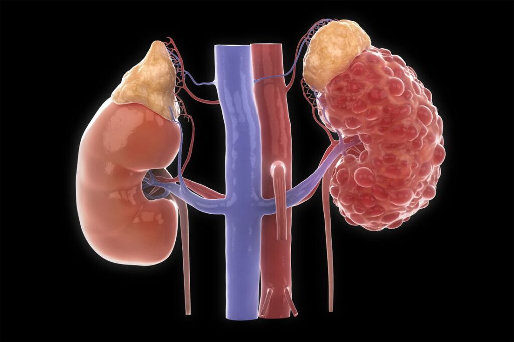 Renal Insufficiency Treatment Market