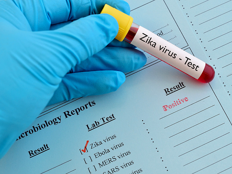 Zika Virus Testing Market