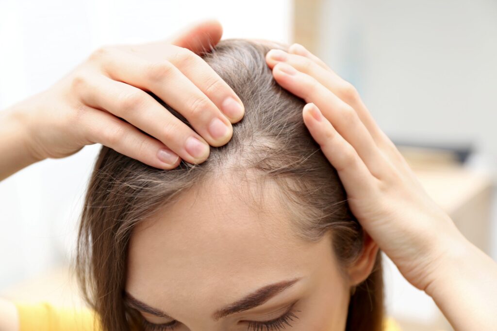 Alopecia Treatment Market