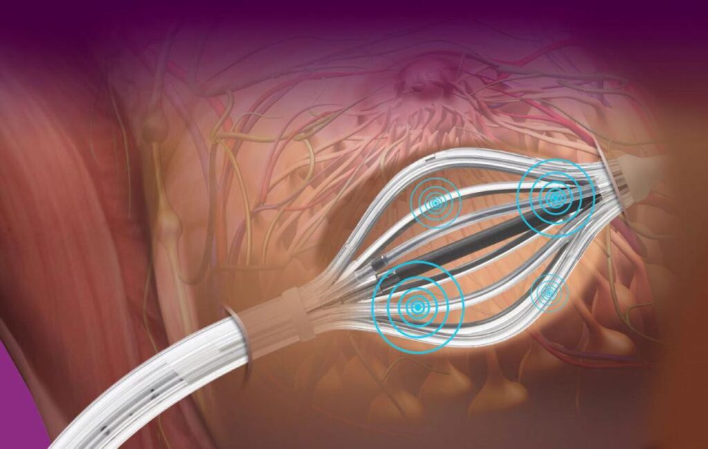 Brachytherapy Market