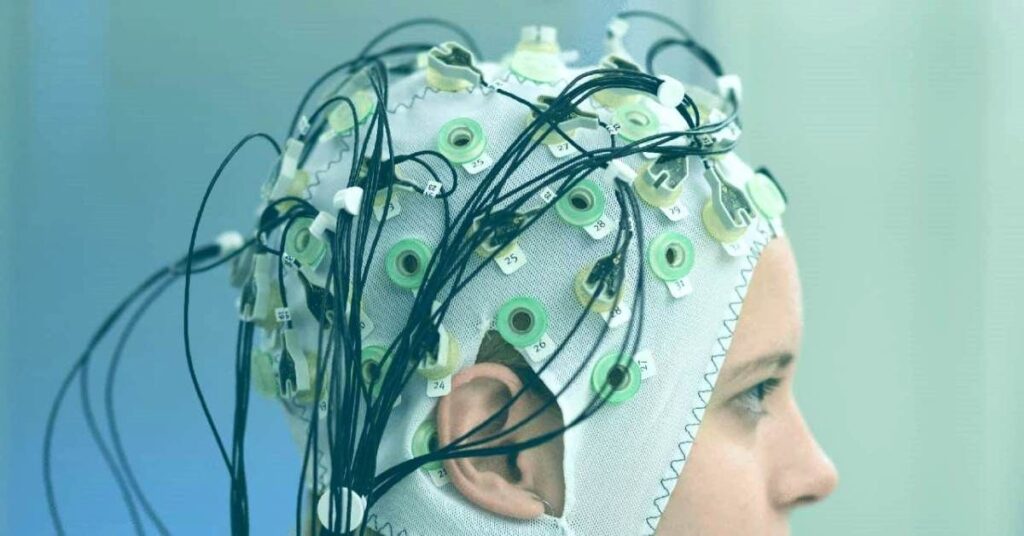 Brain Monitoring Systems Market