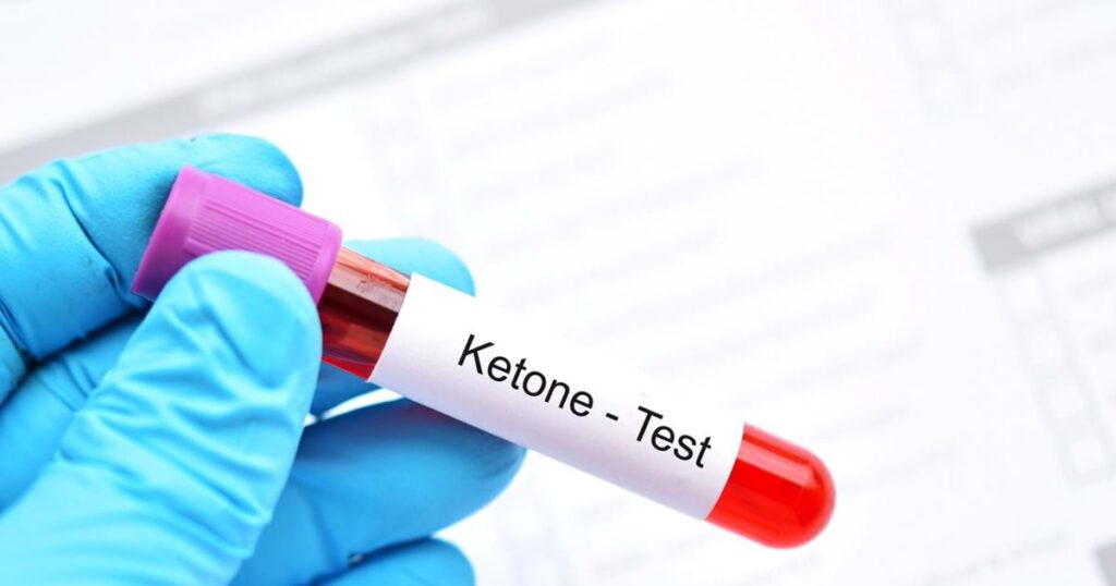 Continuous Ketone Monitoring Market