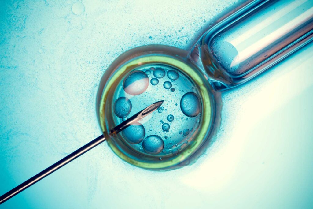 Cryopreservation for In-vitro Fertilization (IVF) Market