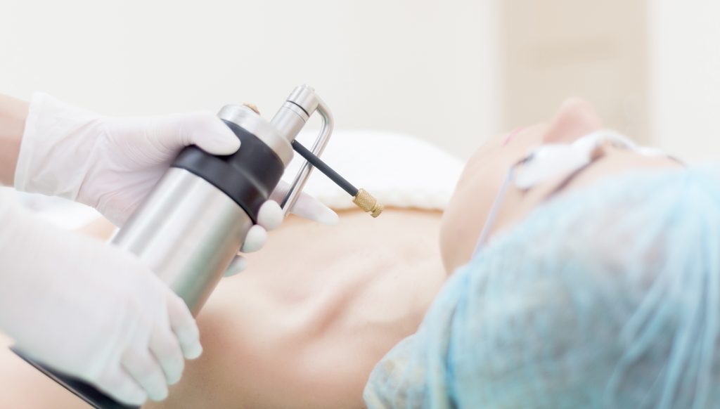 Dermatology Cryosurgery Units Market