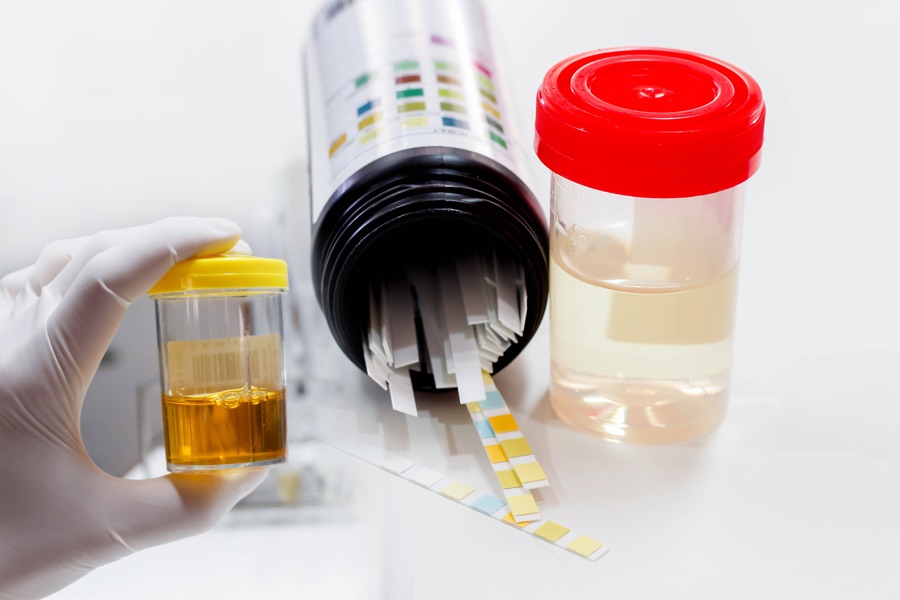 Genomic Urine Testing Market