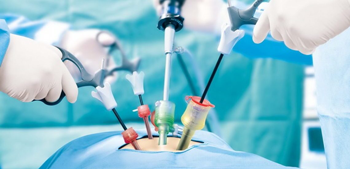 Global Bariatric Surgery Devices Industry