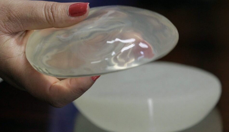 Global Gel Implants Industry