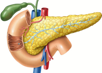 Global Pancreatic Stone Protein Testing Industry